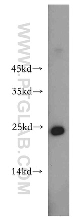 HDDC3 Antibody in Western Blot (WB)