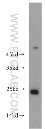 HDDC3 Antibody in Western Blot (WB)