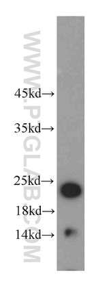 HDDC3 Antibody in Western Blot (WB)