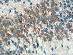 TMCC1 Antibody in Immunohistochemistry (Paraffin) (IHC (P))