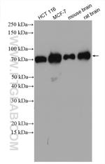 TMCC1 Antibody in Western Blot (WB)