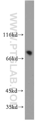 TMCC1 Antibody in Western Blot (WB)