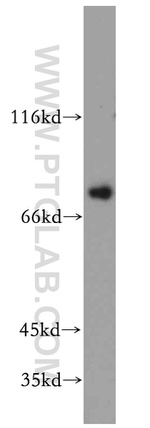 TMCC1 Antibody in Western Blot (WB)