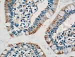 ANKRD13D Antibody in Immunohistochemistry (Paraffin) (IHC (P))