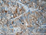 ANKRD13D Antibody in Immunohistochemistry (Paraffin) (IHC (P))