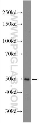 ANKRD13D Antibody in Western Blot (WB)
