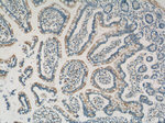 ANKRD13D Antibody in Immunohistochemistry (Paraffin) (IHC (P))