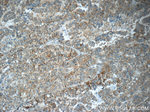 ANKRD13D Antibody in Immunohistochemistry (Paraffin) (IHC (P))