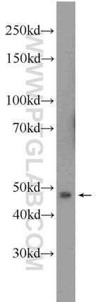 ANKRD13D Antibody in Western Blot (WB)