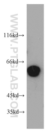 CCDC9 Antibody in Western Blot (WB)