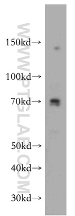 CCDC9 Antibody in Western Blot (WB)