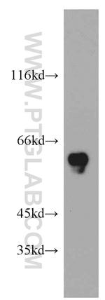 CCDC9 Antibody in Western Blot (WB)
