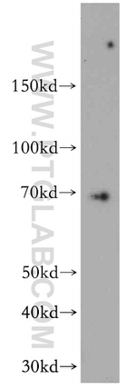 CCDC9 Antibody in Western Blot (WB)