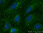 COL26A1 Antibody in Immunocytochemistry (ICC/IF)