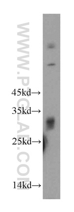 KCTD14 Antibody in Western Blot (WB)