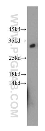 KCTD14 Antibody in Western Blot (WB)