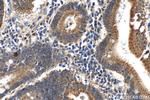 SLC44A5 Antibody in Immunohistochemistry (Paraffin) (IHC (P))