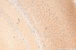 SLITRK1 Antibody in Immunohistochemistry (Paraffin) (IHC (P))