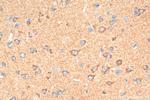 SLITRK1 Antibody in Immunohistochemistry (Paraffin) (IHC (P))