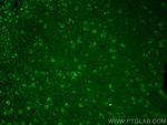 SLITRK1 Antibody in Immunohistochemistry (PFA fixed) (IHC (PFA))