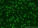 SLITRK1 Antibody in Immunohistochemistry (PFA fixed) (IHC (PFA))