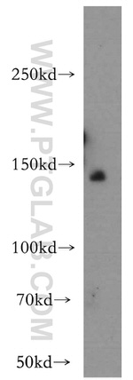 OPLAH Antibody in Western Blot (WB)