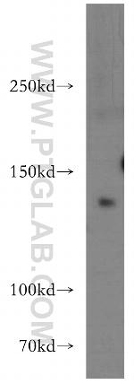 OPLAH Antibody in Western Blot (WB)