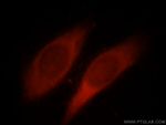 KIAA1199 Antibody in Immunocytochemistry (ICC/IF)