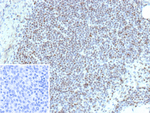 ETS1 (Marker of Tumor Metastasis) Antibody in Immunohistochemistry (Paraffin) (IHC (P))
