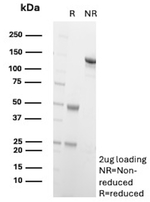 ETS1 (Marker of Tumor Metastasis) Antibody in SDS-PAGE (SDS-PAGE)