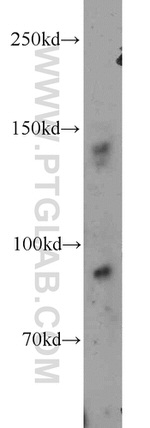 Ceruloplasmin Antibody in Western Blot (WB)