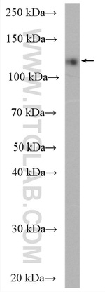 Ceruloplasmin Antibody in Western Blot (WB)