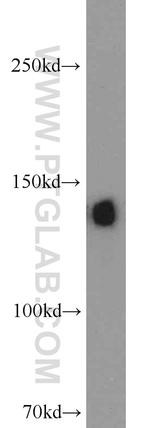 Ceruloplasmin Antibody in Western Blot (WB)