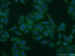 MAN2A1 Antibody in Immunocytochemistry (ICC/IF)