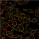 ETS2 (Transcription Factor) Monoclonal Antibody (PCRP-ETS2-1D9)