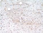 SCGBL Antibody in Immunohistochemistry (Paraffin) (IHC (P))