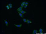 C22orf46 Antibody in Immunocytochemistry (ICC/IF)