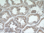 C22orf46 Antibody in Immunohistochemistry (Paraffin) (IHC (P))
