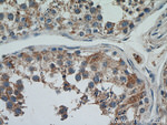 C22orf46 Antibody in Immunohistochemistry (Paraffin) (IHC (P))