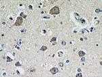 C22orf46 Antibody in Immunohistochemistry (Paraffin) (IHC (P))