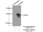 C22orf46 Antibody in Immunoprecipitation (IP)