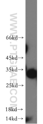 C22orf46 Antibody in Western Blot (WB)