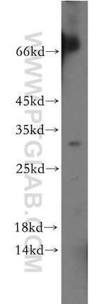 C22orf46 Antibody in Western Blot (WB)