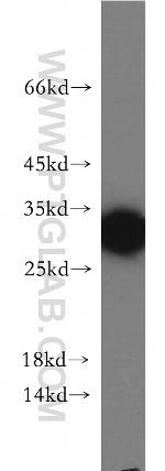 C22orf46 Antibody in Western Blot (WB)