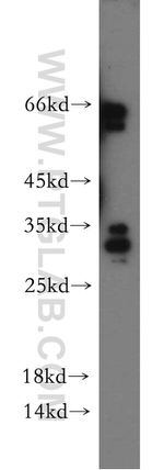 C22orf46 Antibody in Western Blot (WB)