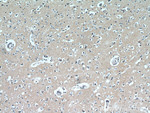 LARS Antibody in Immunohistochemistry (Paraffin) (IHC (P))