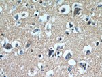 LARS Antibody in Immunohistochemistry (Paraffin) (IHC (P))