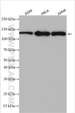 LARS Antibody in Western Blot (WB)