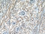 TACO1/CCDC44 Antibody in Immunohistochemistry (Paraffin) (IHC (P))