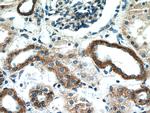 TACO1/CCDC44 Antibody in Immunohistochemistry (Paraffin) (IHC (P))